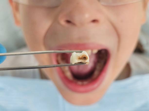 Best Emergency Gum Treatment in Waldpt, OR